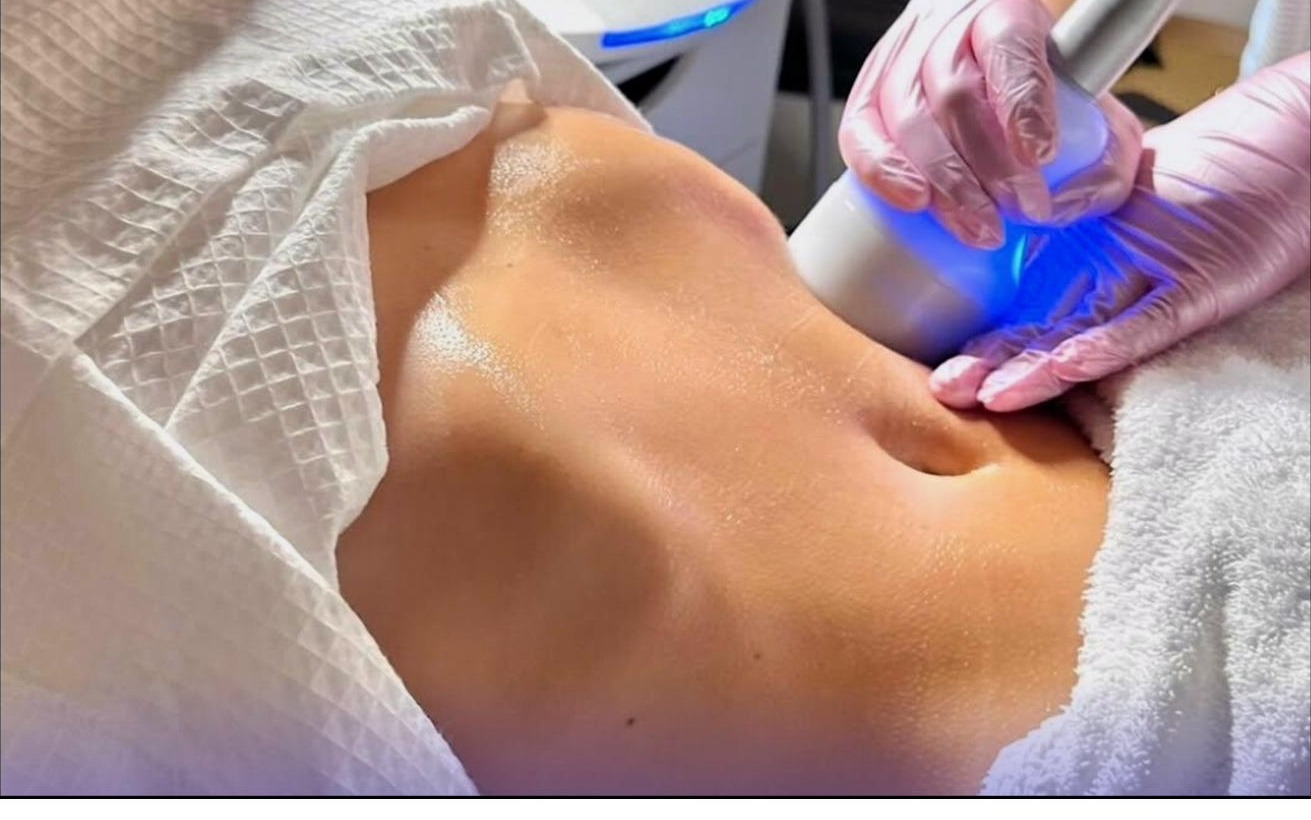 Neveskin cryo body treatment